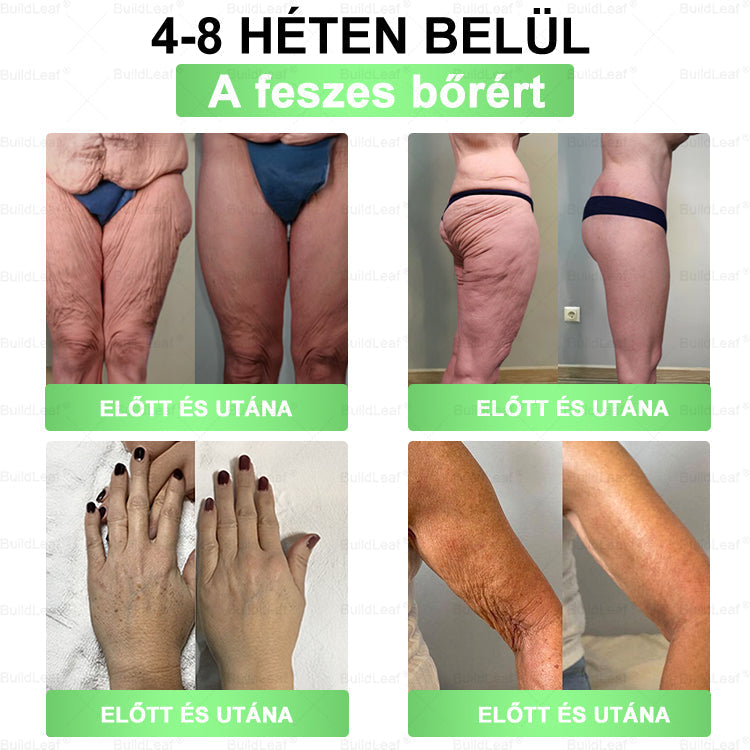 đ„UtolsĂł 5 darab â 50% kedvezmĂ©ny! đż A kĂ©szlet vĂ©ges! Szerezd be MOST a BuildLeafÂź , Ă©s Ă©lvezd a gyors fogyĂĄst fĂ©lĂĄron! đȘ