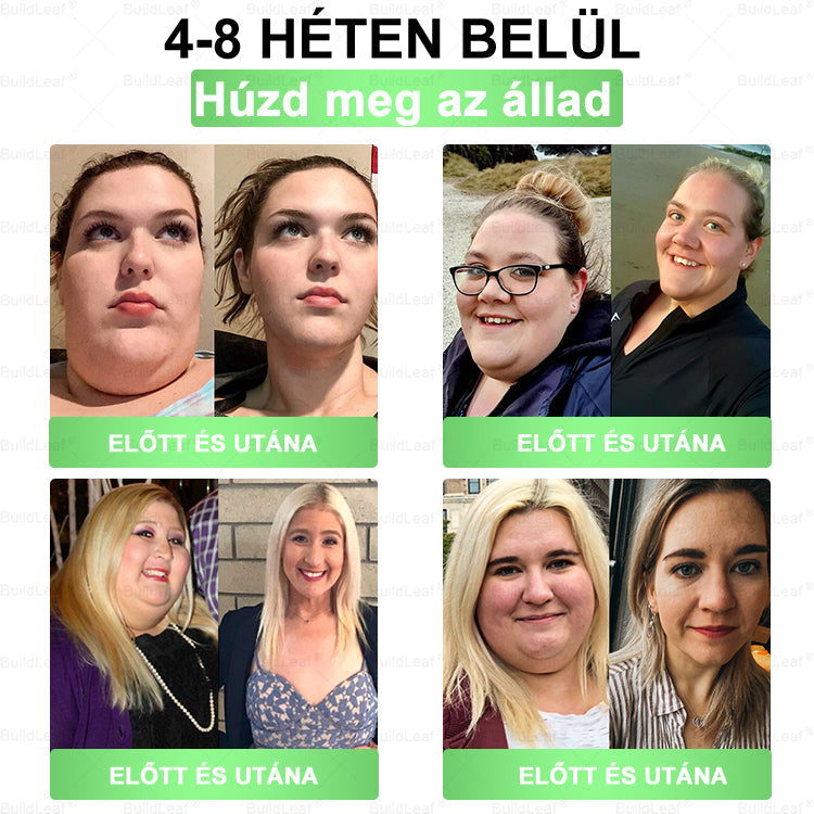 đ„UtolsĂł 5 darab â 50% kedvezmĂ©ny! đż A kĂ©szlet vĂ©ges! Szerezd be MOST a BuildLeafÂź , Ă©s Ă©lvezd a gyors fogyĂĄst fĂ©lĂĄron! đȘ