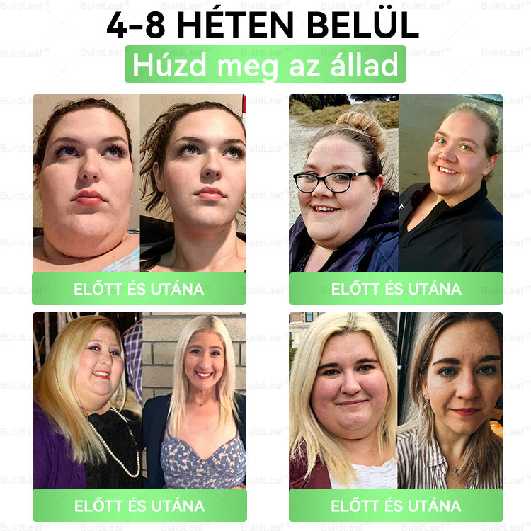 đ„UtolsĂł 5 darab â 50% kedvezmĂ©ny! đż A kĂ©szlet vĂ©ges! Szerezd be MOST a BuildLeafÂź , Ă©s Ă©lvezd a gyors fogyĂĄst fĂ©lĂĄron! đȘ