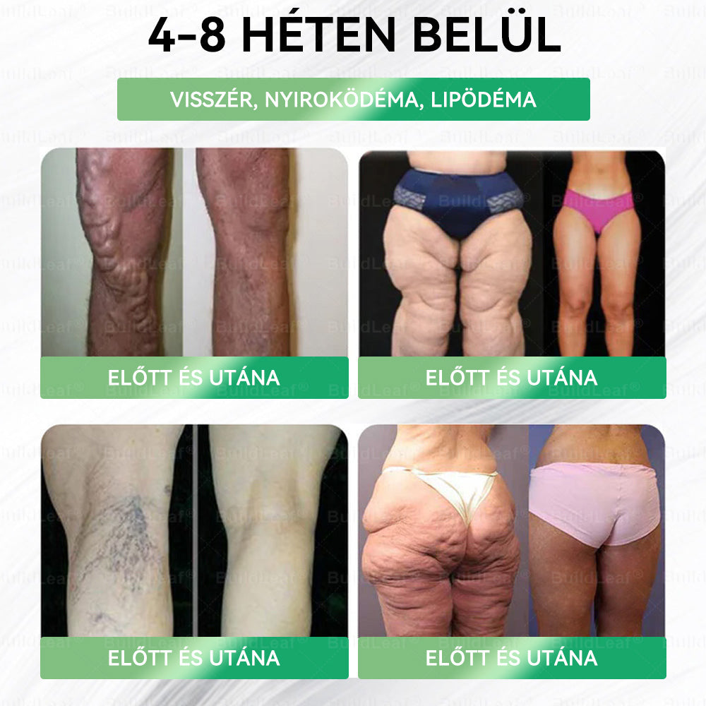 đ„UtolsĂł 5 darab â 50% kedvezmĂ©ny! đż A kĂ©szlet vĂ©ges! Szerezd be MOST a BuildLeafÂź , Ă©s Ă©lvezd a gyors fogyĂĄst fĂ©lĂĄron! đȘ