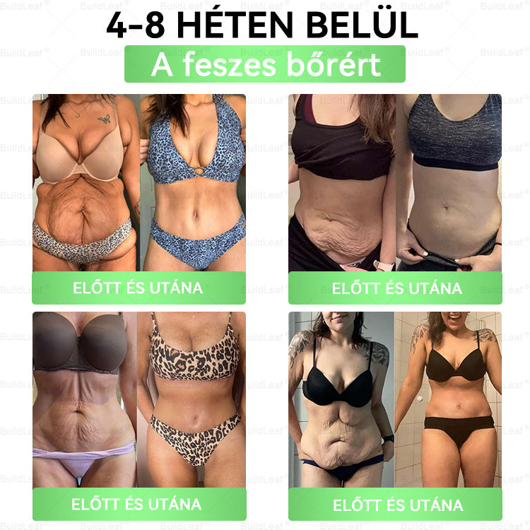 đ„UtolsĂł 5 darab â 50% kedvezmĂ©ny! đż A kĂ©szlet vĂ©ges! Szerezd be MOST a BuildLeafÂź , Ă©s Ă©lvezd a gyors fogyĂĄst fĂ©lĂĄron! đȘ